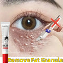 Fat Granules Remover Eye Cream