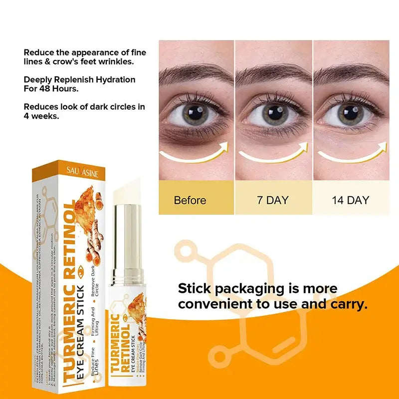 Fat Granules Removal Eye Cream - Nurture By Nala