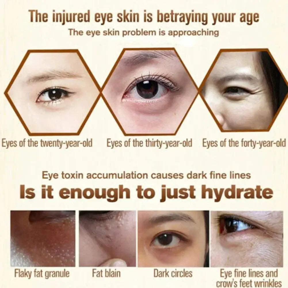 Infographic showing eye skin aging and issues such as flaky fat granules, dark circles, and fine lines for different age groups