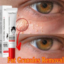 Whitening cream for fat granules removal near eyes showing before and after results, unisex moisturizing eye cream with kojic acid.