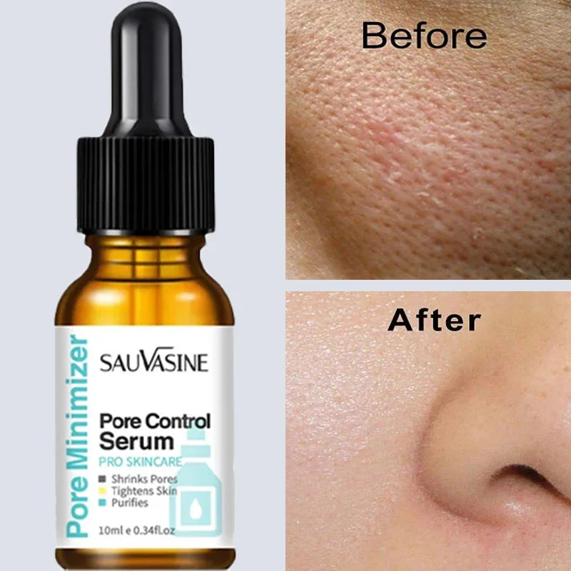 Removing Large Pores Pore Shrinking Serum Face - Nurture By Nala