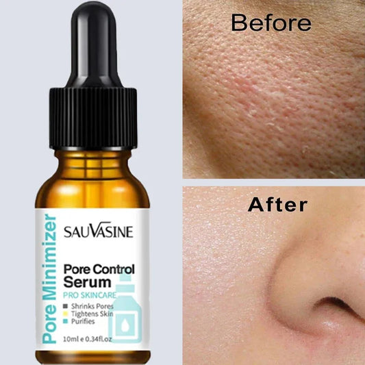 Removing Large Pores Pore Shrinking Serum Face - Nurture By Nala