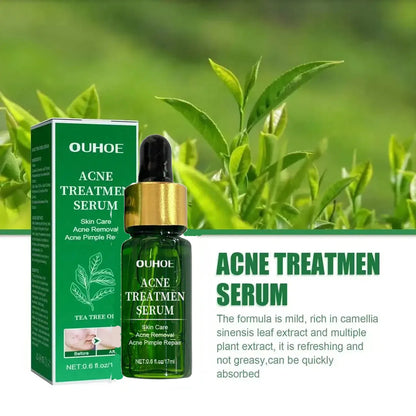 Acne Treatment Facial Serum Pore Shrinking Skin Care - Nurture By Nala