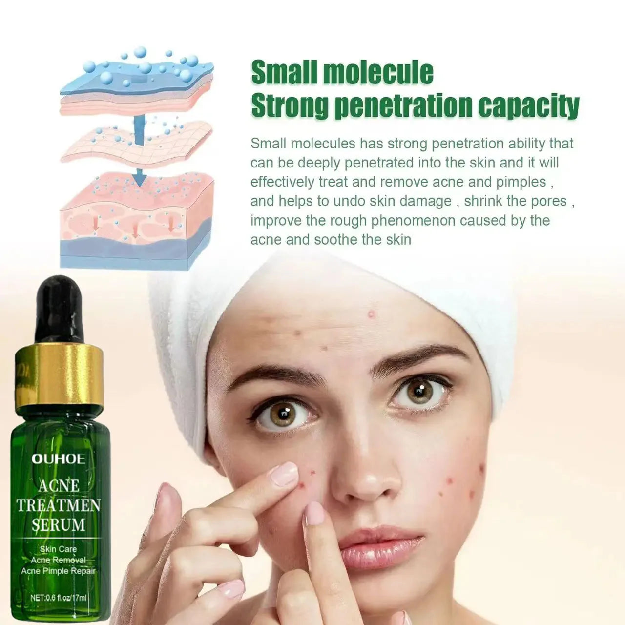 Acne Treatment Facial Serum Pore Shrinking Skin Care - Nurture By Nala